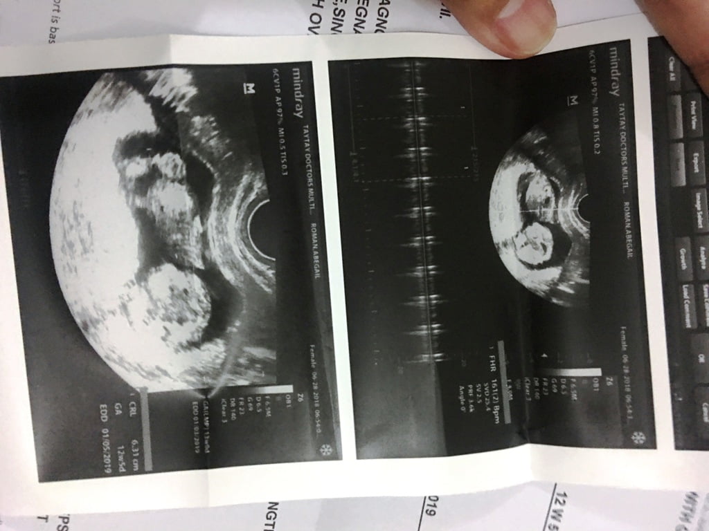 Preg' (3)